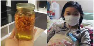 BS trả về, cô gái ở nhà kiên trì dùng gừng pha mật ong, đi khám lại thì tế bào ung thư đã mất