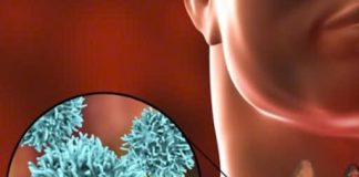 Người đàn ông 35 tuổi đau họng t:uvo:::ng sau 5 lần hóa trị, bác sĩ khẩn cầu: Vứt 2 thứ trong tủ lạnh đi