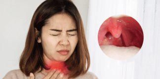 Cảnh báo: Khi thấy cơ thể có dấu hiệu này phải tới bệnh viện ngay kẻo u:ng th:ư vòm họng giai đoạn cuối