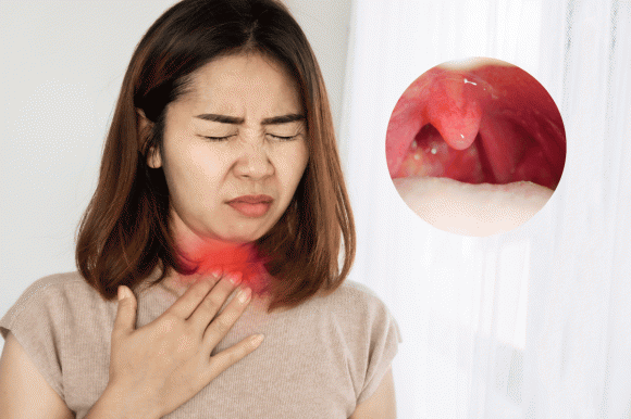 ung thư vòm họng, dấu hiệu ung thư vòm họng