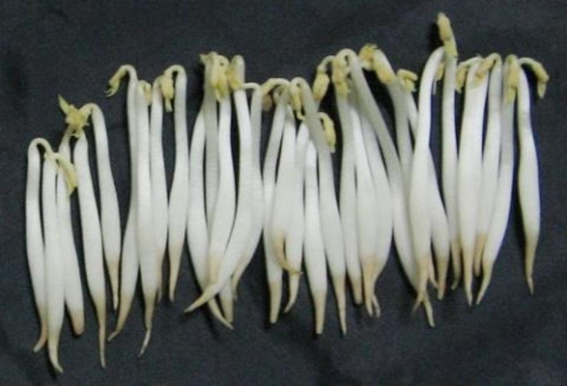 Loại rau ᵭứng ᵭầu danh sách “vua hại gan”, còn ăn ᵭừng trách gan sớm hỏng- Ảnh 3.