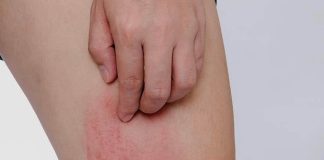 Hai bộ phận trên cơ thể ngứa ngáy là dấu hiệu của bệnh ung thư gan, nhiều người lại lầm tưởng là dị ứng