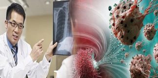 Sɑu nhiều năm, BS nhận ɾɑ Ьệnh nhân ung thư luôn có 6 ƌiểm chung vào Ьuổi sáng: Ngẫm lại quá ƌúng