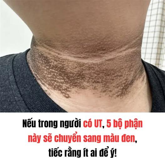 592350070_1313961117438562_8269259357474532502_n