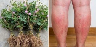 Cây xấu hổ: công dụng và bài thuốc chữa bệnh được dân gian tin dùng