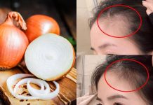 Mẹo sử dụng hành tây giúp tóc con mọc tua tủa, càng dùng tóc càng dày và bóng mượt