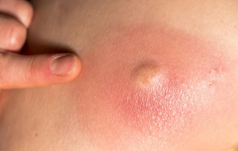 Cây rau má lá rau muống và những công dụng bất ngờ 3